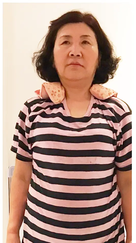 ビフォー
